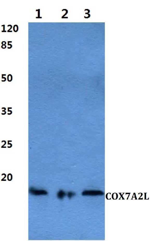 Western blot (WB) analysis of COX7A2L polyclonal antibody at 1:500 dilution
Lane1:HepG2 cell lysate
Lane2:Raw264