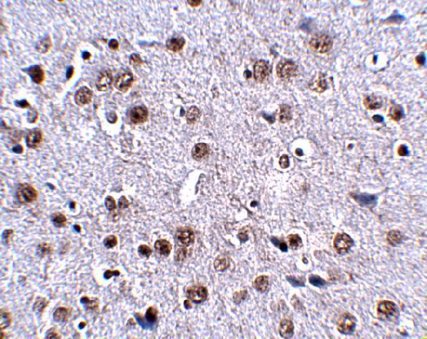 a12062 lrfn4 primary antibodies ihc testing 2