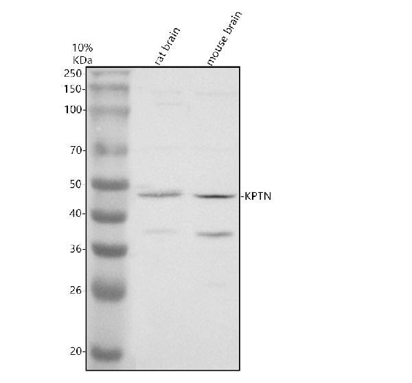 Western blot analysis of KPTN using anti-KPTN antibody (A12065-1)