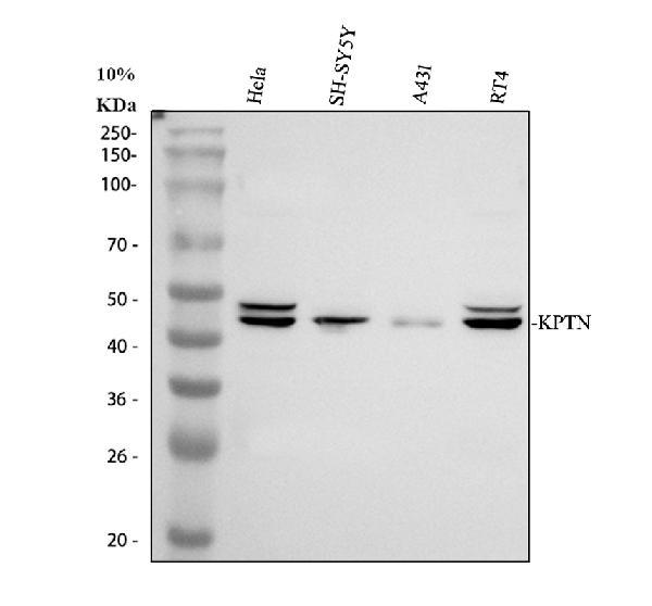 Western blot analysis of KPTN using anti-KPTN antibody (A12065-1)