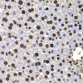 a12067 hirip3 primary antiboties ihc testing 4