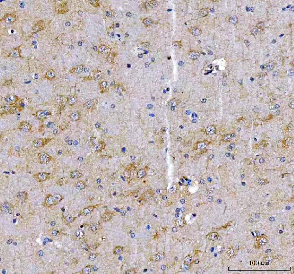 Figure 2. IHC analysis of LRRN1 using anti-LRRN1 antibody (A12074-1). LRRN1 was detected in a paraffin-embedded section of rat brain tissue. Heat mediated antigen retrieval was performed in EDTA buffer (pH 8.0, epitope retrieval solution). The tissue section was blocked with 10% goat serum. The tissue section was then incubated with 2 microg/ml rabbit anti-LRRN1 Antibody (A12074-1) overnight at 4°C. Peroxidase Conjugated Goat Anti-rabbit IgG was used as secondary antibody and incubated for 30 minutes at 37°C. The tissue section was developed using HRP Conjugated Rabbit IgG Super Vision Assay Kit (Catalog # SV0002) with DAB as the chromogen.