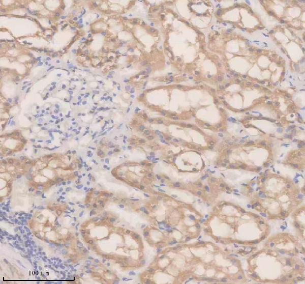 IHC analysis of DAAM2 using anti-DAAM2 antibody (A12080-1)