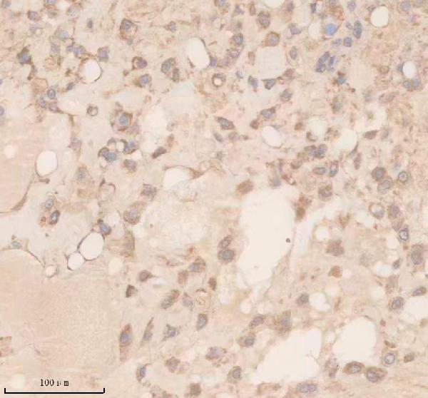 IHC analysis of DAAM2 using anti-DAAM2 antibody (A12080-1)