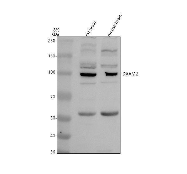 Western blot analysis of DAAM2 using anti-DAAM2 antibody (A12080-1)