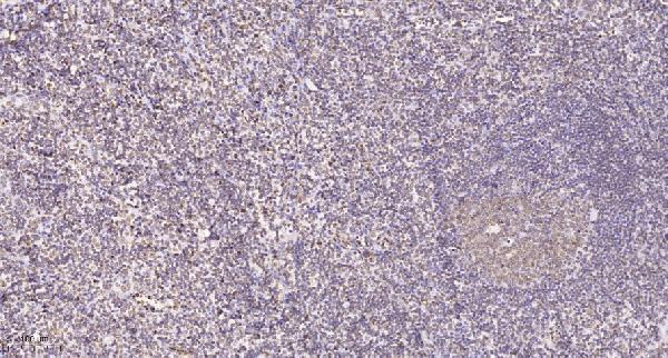 a12083 pgbd1 primary antibodies ihc testing 1