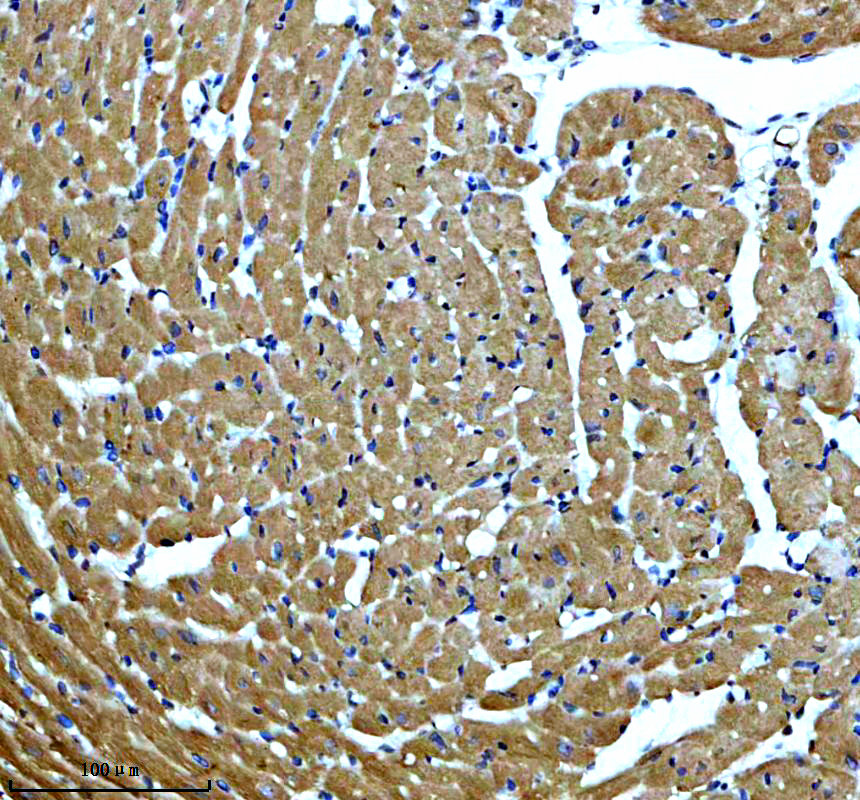 IHC analysis of MYOM2 using anti-MYOM2 antibody (A12094-1)