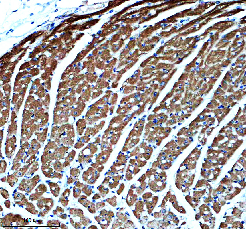 IHC analysis of MYOM2 using anti-MYOM2 antibody (A12094-1)