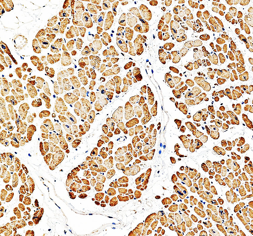a12094 1 myom2 primary antibodies ihc testing 3