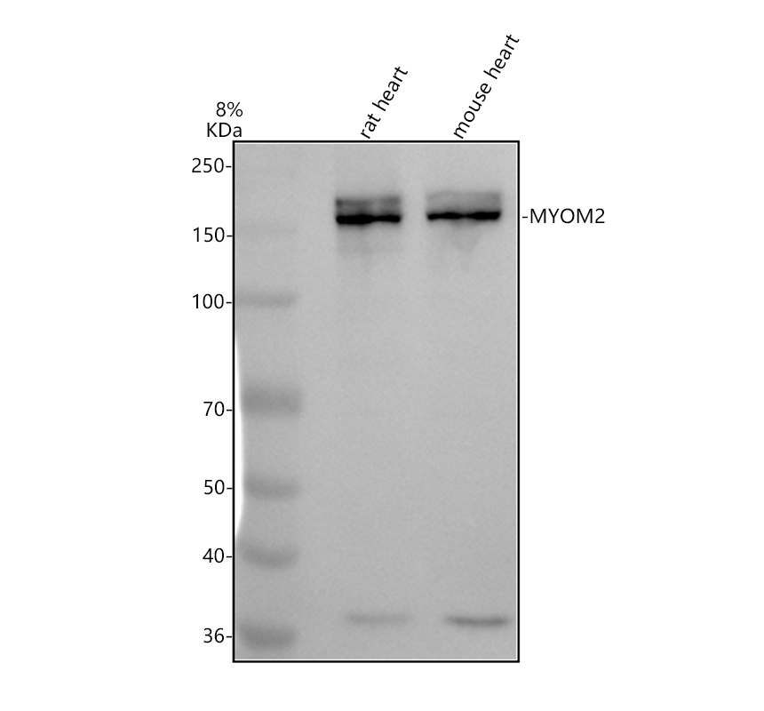 Western blot analysis of MYOM2 using anti-MYOM2 antibody (A12094-1)