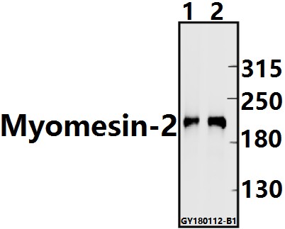 Western blot (WB) analysis of Myomesin-2 (Y644) pAb at 1:1000 dilution
Lane1:The Heart tissue lysate of Rat(10ug)
Lane2:The Heart tissue lysate of Mouse(10ug)