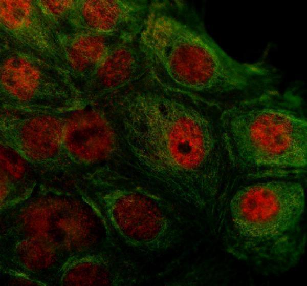 a12095 1 gpcpd1 primary antibodies if testing 1