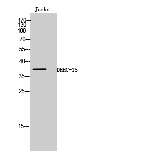 a12099 zdhhc15 primary antibodies wb testing 2