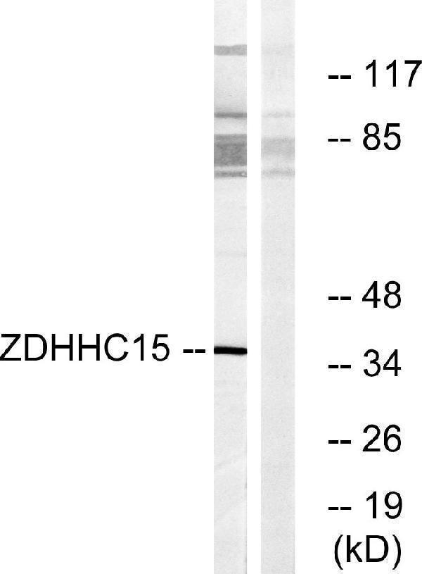 a12099 zdhhc15 primary antibodies wb testing 3