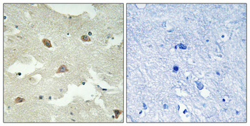 a12107 nsg1 primary antibodies ihc testing 1