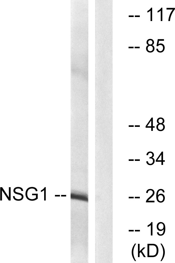 Western blot analysis of lysates from COLO cells, using NSG1 Antibody