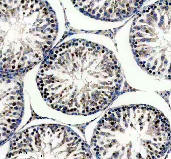 IHC analysis of POLE3 using anti-POLE3 antibody (A12109-2)