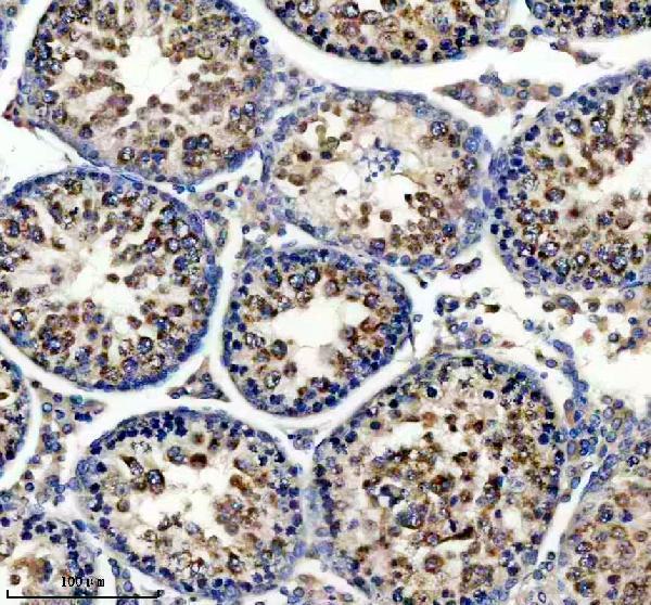 IHC analysis of POLE3 using anti-POLE3 antibody (A12109-2)