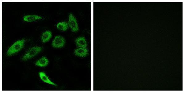 a12110 tas2r3 primary antibodies if testing 1