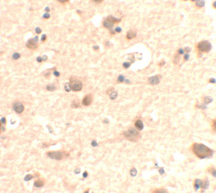 a12113 1 rusc2 primary antibodies ihc testing 2