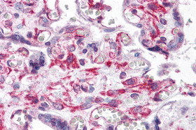 a12113 rusc2 primary antibodies ihc testing 1