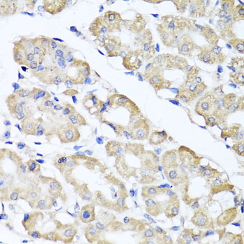 Immunohistochemistry of paraffin-embedded human gastric using SPICE1 antibody at dilution of 1:100 (x40 lens)
