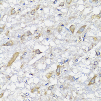 Immunohistochemistry of paraffin-embedded rat brain using SPICE1 antibody at dilution of 1:100 (x40 lens)