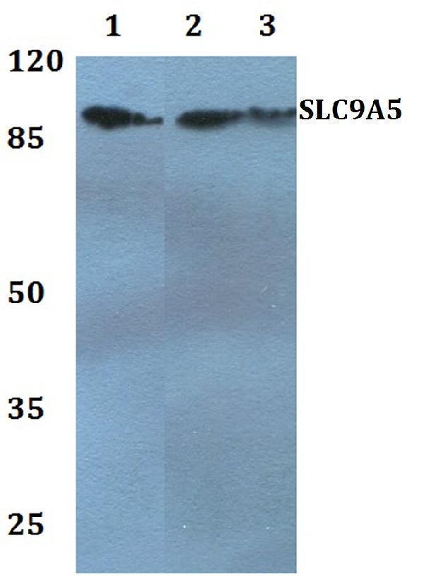 Western blot (WB) analysis of SLC9A5 polyclonal antibody at 1:500 dilution
Lane1:HepG2 whole cell lysate
Lane2:NIH-3T3 whole cell lysate
Lane3:Rat brain tissue lysate