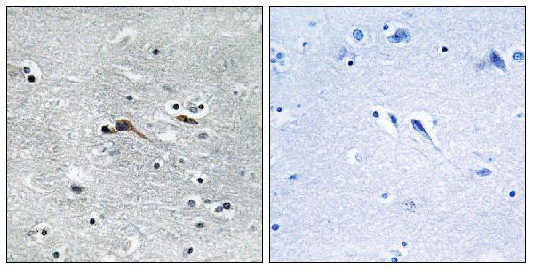 a12117 cytl1 primary antibodies ihc testing 1