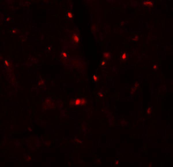 a12118 slc27a6 primary antibodies if testing 3
