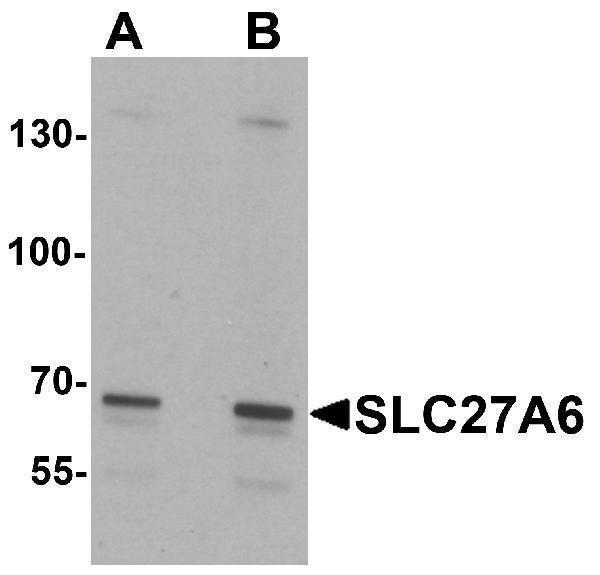 a12118 slc27a6 primary antibodies wb testing 1