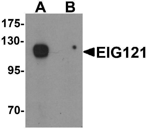 Western blot analysis of EIG121 in MCF7 cell lysate with EIG121 antibody at 1 μg/mL in (A) the absence and (B) the presence of blocking peptide