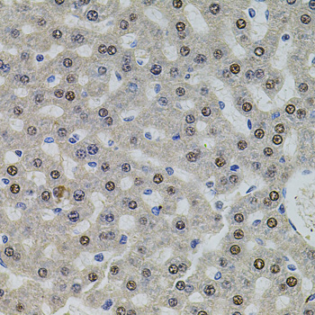 Immunohistochemistry of paraffin-embedded rat liver using U2SURP antibody  at dilution of 1:100 