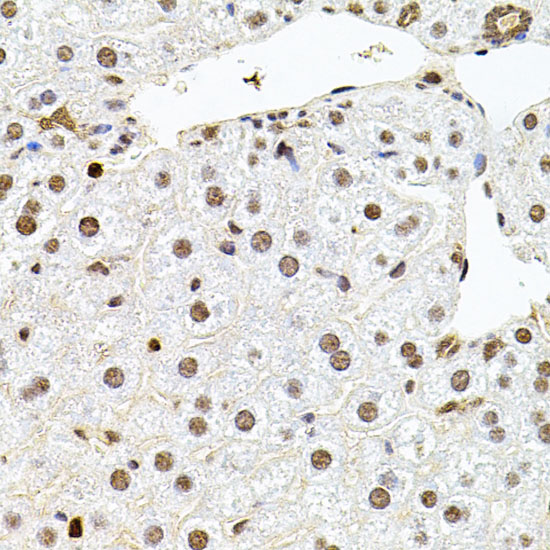 a12125 u2surp primary antiboties ihc testing 4