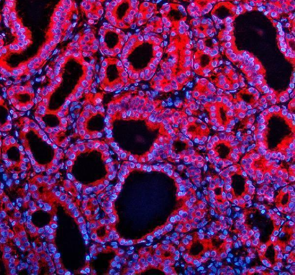 a12135 tenm2 primary antibodies if testing 1