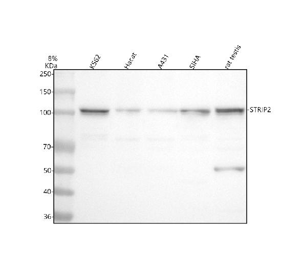 Figure 1. Western blot analysis of FAM40B/STRIP2 using anti-FAM40B/STRIP2 antibody (A12139). Electrophoresis was performed on a 5-20% SDS-PAGE gel at 70V (Stacking gel) / 90V (Resolving gel) for 2-3 hours. The sample well of each lane was loaded with 30 ug of sample under reducing conditions. Lane 1: human K562 whole cell lysates, Lane 2: human Hacat whole cell lysates, Lane 3: human A431 whole cell lysates, Lane 4: human SiHa whole cell lysates, Lane 5: rat testis tissue lysates. After electrophoresis, proteins were transferred to a nitrocellulose membrane at 150 mA for 50-90 minutes. Blocked the membrane with 5% non-fat milk/TBS for 1.5 hour at RT. The membrane was incubated with rabbit anti-FAM40B/STRIP2 antigen affinity purified polyclonal antibody (Catalog # A12139) at 0.5 microg/mL overnight at 4°C, then washed with TBS-0.1%Tween 3 times with 5 minutes each and probed with a goat anti-rabbit IgG-HRP secondary antibody at a dilution of 1:5000 for 1.5 hour at RT. The signal is developed using an Enhanced Chemiluminescent detection (ECL) kit (Catalog # EK1002) with Tanon 5200 system. A specific band was detected for FAM40B/STRIP2 at approximately 100 kDa. The expected band size for FAM40B/STRIP2 is at 95 kDa.