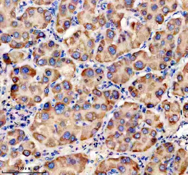 IHC analysis of TRIM40 using anti-TRIM40 antibody (A12141-3)