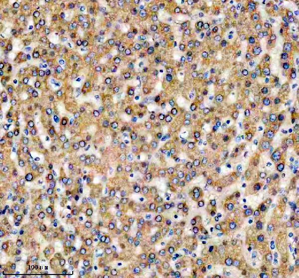 IHC analysis of TRIM40 using anti-TRIM40 antibody (A12141-3)