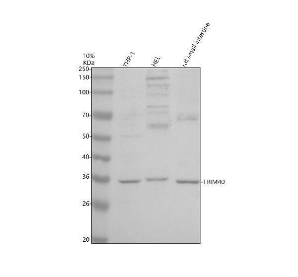 Western blot analysis of TRIM40 using anti-TRIM40 antibody (A12141-3)