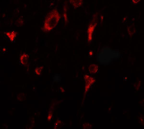 a12146 sgsm2 primary antibodies if testing 2