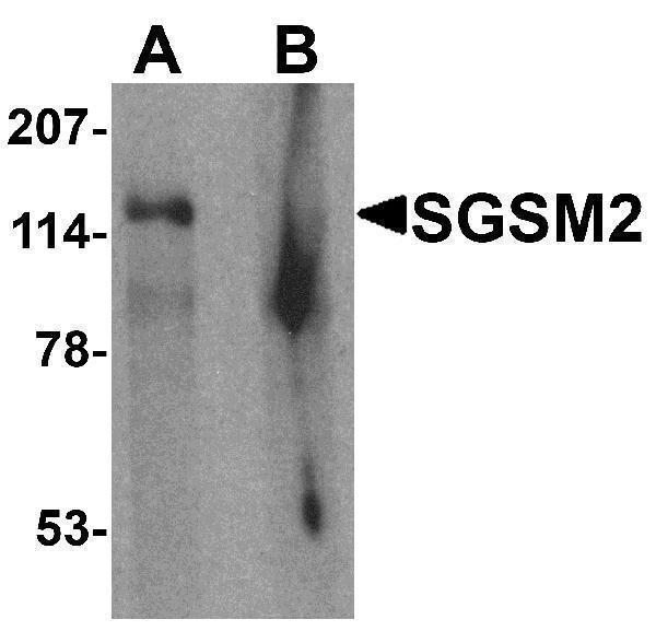 a12146 sgsm2 primary antibodies wb testing 1