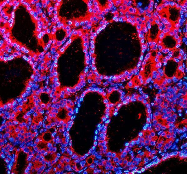 IF analysis of TMED1 using anti-TMED1 antibody (A12148-1)