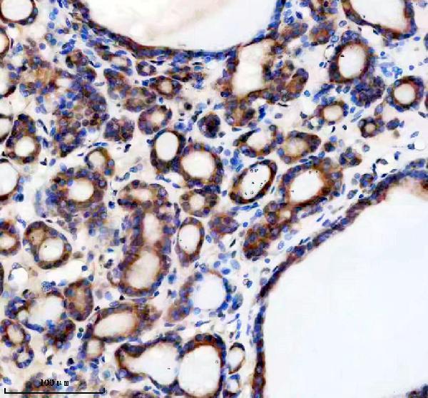 IHC analysis of TMED1 using anti-TMED1 antibody (A12148-1)