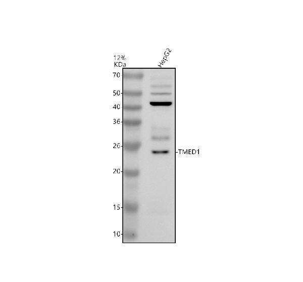 Western blot analysis of TMED1 using anti-TMED1 antibody (A12148-1)