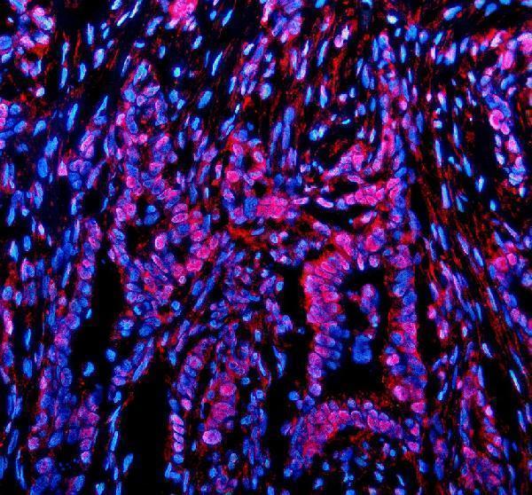 a12154 2 tkfc primary antibodies if testing 1