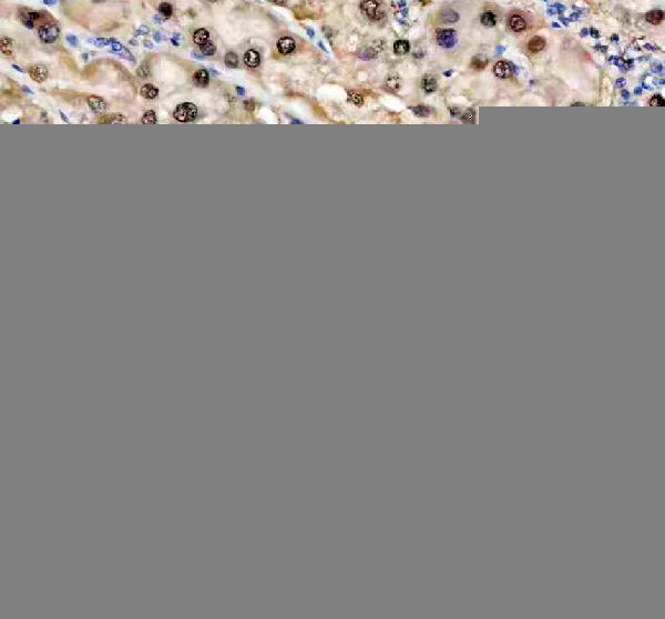IHC analysis of DAK/TKFC using anti-DAK/TKFC antibody (A12154-2)