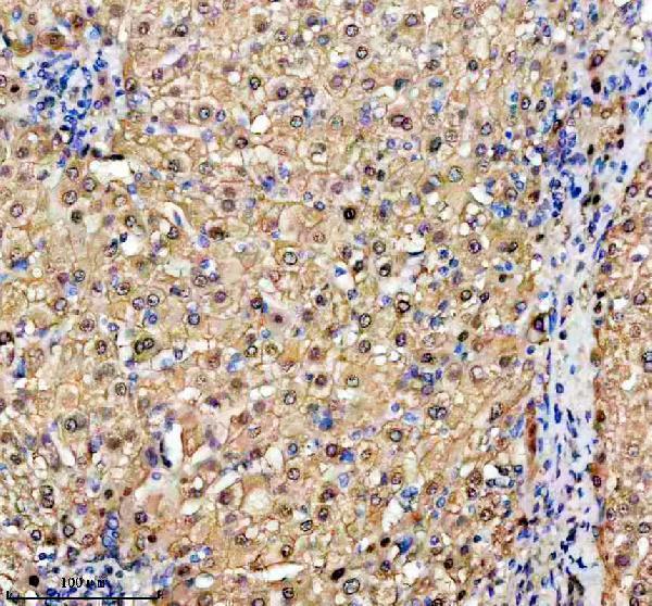 IHC analysis of DAK/TKFC using anti-DAK/TKFC antibody (A12154-2)