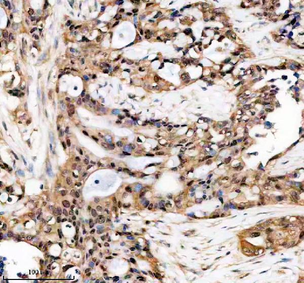 a12154 2 tkfc primary antibodies ihc testing 3