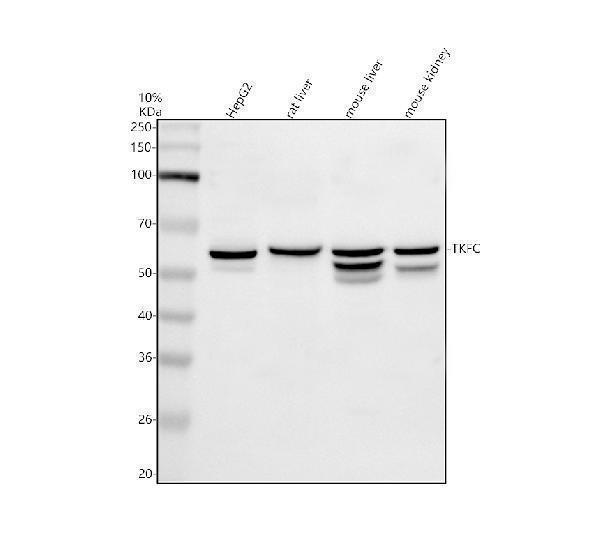 Western blot analysis of DAK/TKFC using anti-DAK/TKFC antibody (A12154-2)