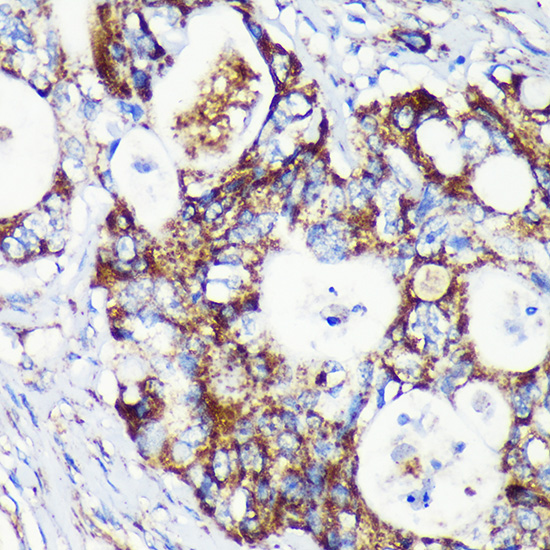 a12159 taco1 primary antiboties ihc testing 2